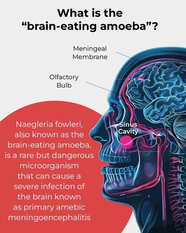 brain-eating amoeba